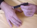 La moxibustion